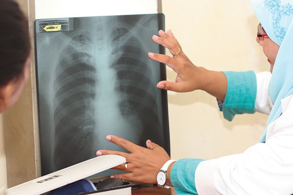 Otsuka Pharmaceutical is cooperating on a project to improve TB treatment in developing countries. In Indonesia, it is working with a local university to support the evaluation of treatment for TB and MDR-TB.